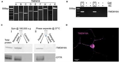 Reduced Expression of TMEM16A Impairs Nitric Oxide-Dependent Cl− Transport in Retinal Amacrine Cells